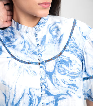 Sky Blue Cotton Printed Mini Dress with Lace Detail